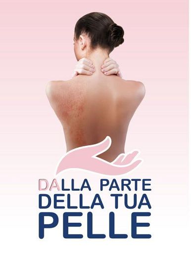 Dermatite atopica, tornano gli open day: consulti gratuiti in tutta Italia